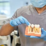 rodzaje implantów zębowych